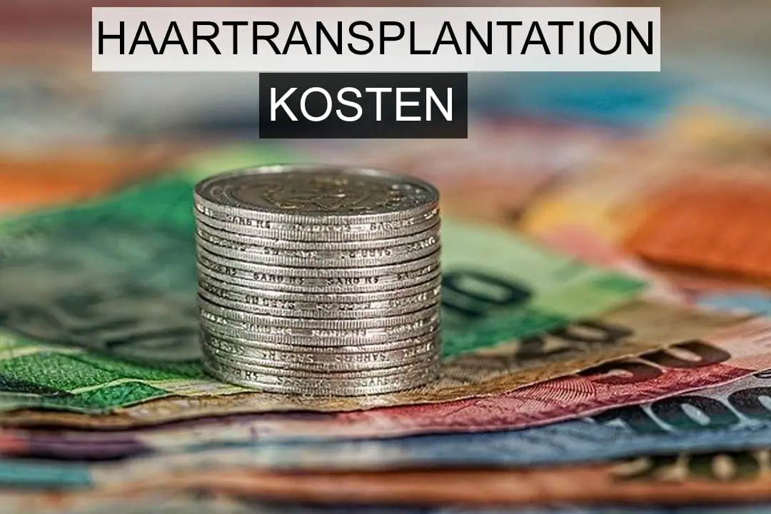Haartransplantation Kosten Deutschland Schweiz Zürich Österreich Westeuropa