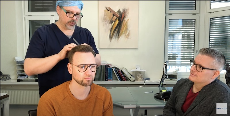 Haartransplantation Update Geheimratsecken Vorher Nachher J. Hansen Video Dr. Heitmann